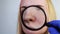 Expanded rosacea, pores, black spots, acne close-up on the nose. A woman is being examined by a doctor. Dermatologist examines the