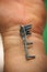 explanted surgical blue titanium radius plate lies on the wrist