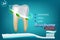 Extra Whitening Toothpaste Healthy Teeth Concept. Vector Realistic Set Illustration 3d Extruded Toothpaste, Brandname