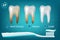 Extra Whitening Toothpaste Healthy Teeth Concept. Vector Realistic Set Illustration 3d Extruded Toothpaste, Brandname