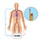 Extracorporeal membrane oxygenation,ecmo in intensive care depar