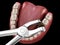 Extraction of Molar tooth damaged by caries. Medically accurate tooth 3D illustration