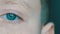 Extraordinarily beautiful turquoise eyes of teenage boy with freckles on his face close up view. Serious view of the boy