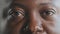 Extreme close up african male face in detail adult man model client of ophthalmology with dark skin tired unhealthy
