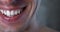 Extreme close-up man smiling isolated white teeth. Dental care and dentistry concept. Beautiful male smile. Macro shot.