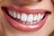 Extreme close-up of an unrecognizable female white Caucasian smiling and showing dazzling bright white teeth - dental health