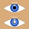 Eye with cataract and normal. Vector illustration of healthy and illness optic organ. Blurred vision in glaucoma. Diagnosis and