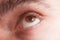 Eye with contact lens macro