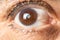 Eye of an elderly man with cataracts, clouding of the lens, macro.