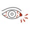 Eye pain and infection thin line icon, illness and injury concept, Sore eyes sign on white background, Redness of eyes