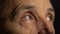 The eyes of an older man. Capillaries on the eyeball