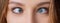 Eyes with squinted look and eyebrows on male face. Female eyes with strabismus. Hypertropia. Woman eyes suffering from