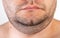 The face of an overweight man. Fat double chin. Aesthetic defect. double chin correction, close-up