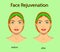 Face rejuvenation, vector illustration with before after effect