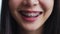 Face of a young smiling asian woman with braces on teeth, Orthodontic Treatment