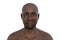 Facial palsy in an African man, 3D illustration highlighting the asymmetry and drooping of the facial muscles on one side of the