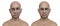 Facial palsy in a man and the same healthy man, 3D illustration showing the asymmetry and drooping of the facial muscles on one