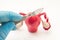 Fallopian tube surgery for treat infertility or ectopic pregnancy photo concept. Doctor`s hand with a scalpel is above the anatomi