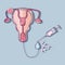Fallopian tubes and artificial insemination process