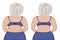 Fat and slim girl`s back. Fat thig. Liposuction. Before and after. Woman body correction