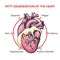 Fatty Degeneration of the Heart. Symptoms of decease illustration