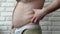 Fatty folds appear on the belly and sides of a fat person. Obesity disease. Fat man