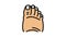 fatty foot edema color icon animation