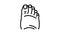 fatty foot edema line icon animation