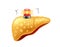 Fatty liver symbol with siren.