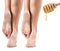 Feet with dry skin before and after honey treatment.