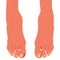 Feet with ingrown toenails.Disease, fungus or inflammation in fingernails. Legs problem area with pus and blood.Right pedicure,bod