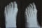 Feet X ray