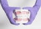 Female dentist hand in medical purple gloves holding teeth model