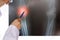 Female doctor`s hand using pen to pointing patient`s knee joins X-ray film on glowing screen in radiology orthopedic unit at