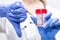 Female doctor in white coat and gloves holds container and shows thumbs down, bad analysis. White background. Timely