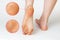 Female feet with corns and calluses, on a white background. Foot close-up. Zoomed image of skin lesions. Cosmetology and medicine