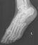 female feet xray radiograph