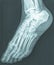 female feet xray radiograph