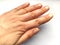 Female hand with dry atopic skin. White background. Close-up of the skin on the hands and fingers. Derma in need of care and