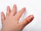 A female hand with nail peeling problem on the white background.