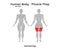 Female Human Body - Muscle map, Hamstrings
