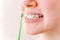 Female mouth with braces and a special brush for interdental spaces close-up on a light background