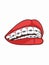 Female mouth with  teeth and  dental braces illustration black and white colors  illustration