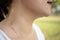 Female neck with sweat on skin,asian woman with atopic allergy skin with red spots caused by sweating,scratching because of the