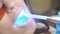 Female patient getting treatment with dental UV light equipment