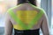 Female wearing kinesio tapes at her back and shoulders at doctor office