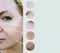 Female wrinkles before and after difference mature regeneration beautician therapy procedures collage