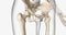 A femoral neck fracture is a type of hip fracture that occurs in the section of the femur closest to the pelvis