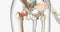 A femoral neck fracture is a type of hip fracture that occurs in the section of the femur closest to the pelvis