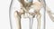 A femoral neck fracture is a type of hip fracture that occurs in the section of the femur closest to the pelvis